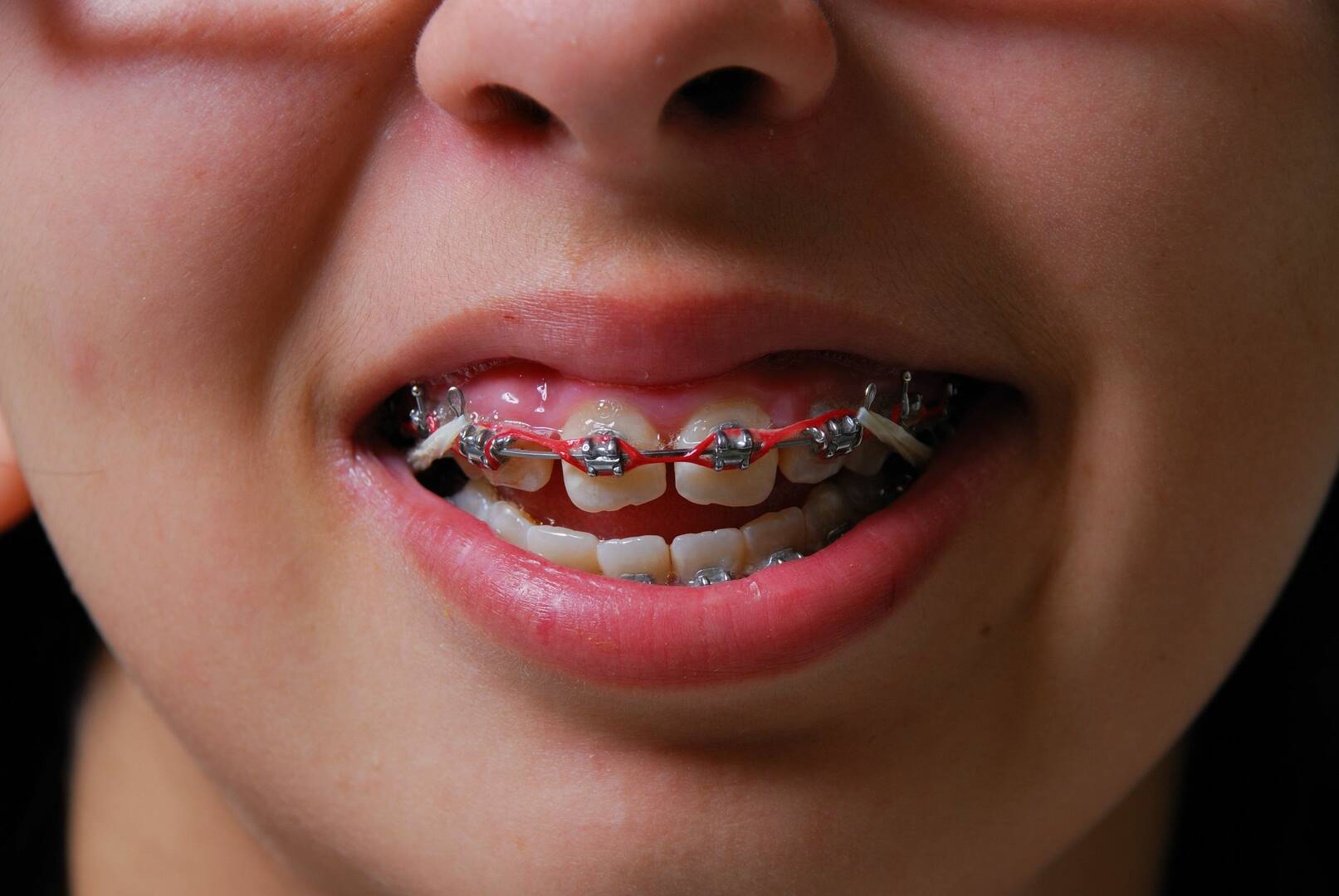 Judd Dentistry PA