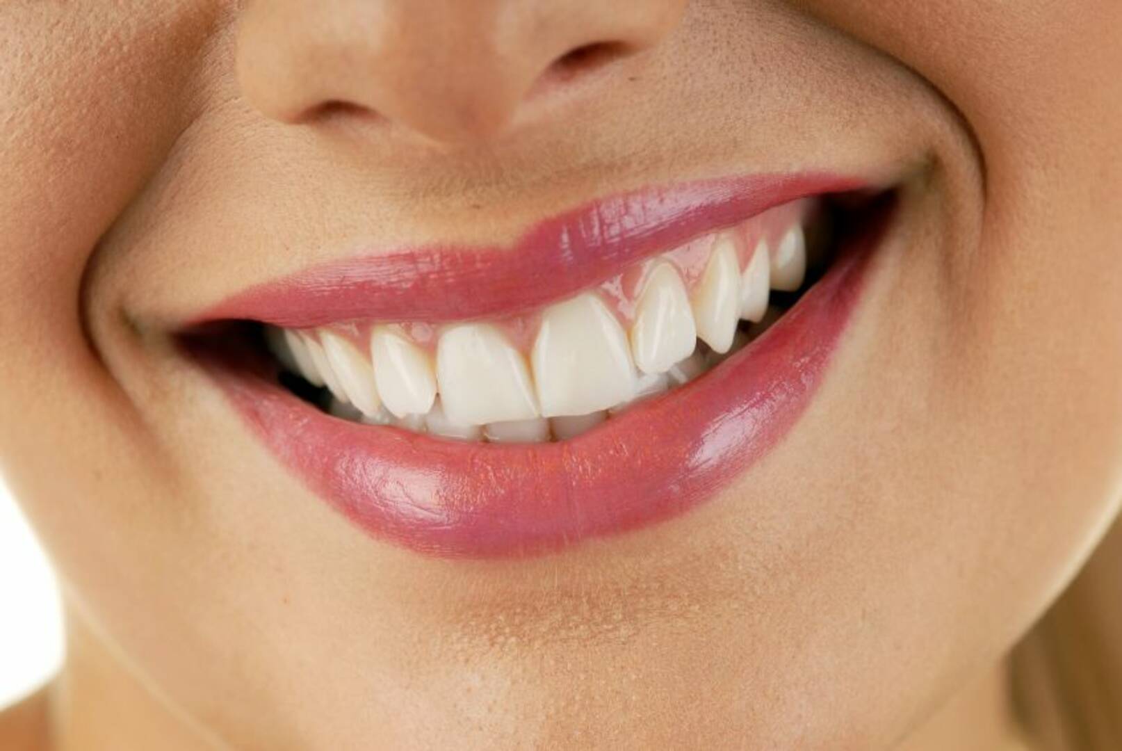 Smile Fresh Dental